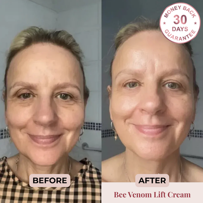 Bee Venom Lifting+ Cream Shape Muse